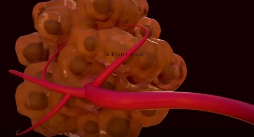 Tumor_de_cancer_y_venas