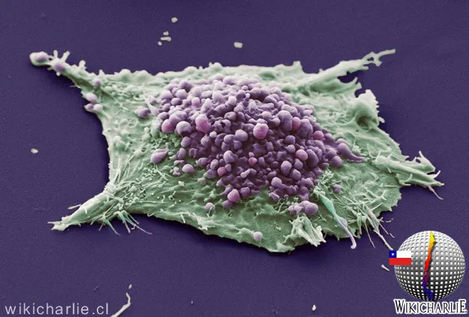 Celulas_epiteliales_de_cancer_de_pulmon